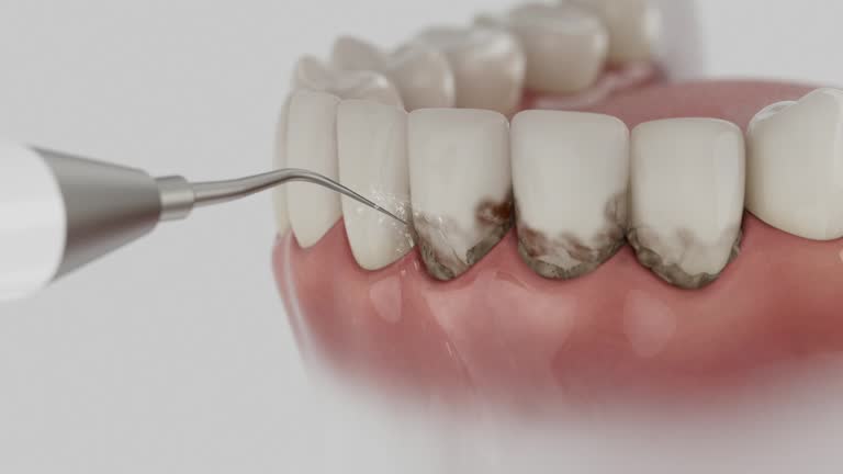 Trusted Teeth Whitening service in Johnson City, KS - Dentist Open Now
